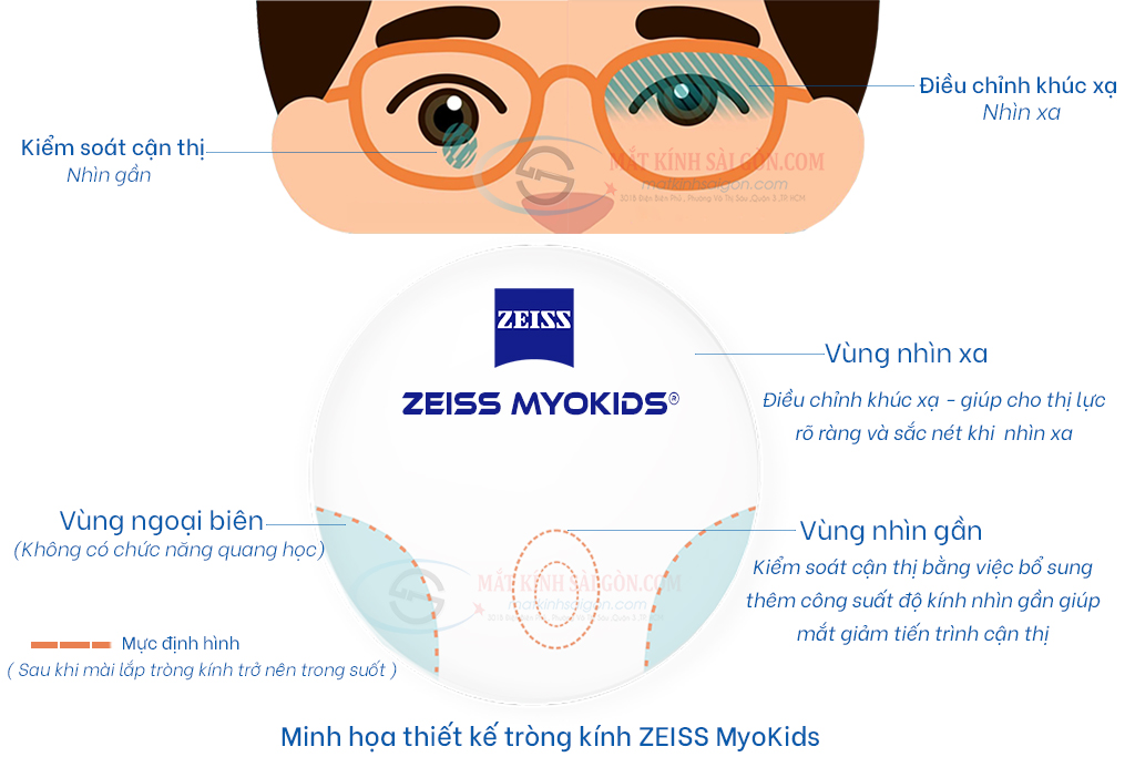 TRÒNG KÍNH 1.56 ZEISS MYOKIDS - Hover